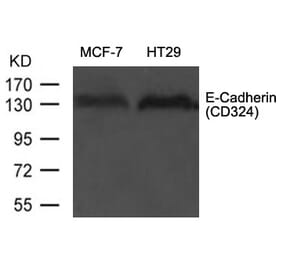 Western blot - E-Cadherin (CD324) Antibody from Signalway Antibody (21473) - Antibodies.com