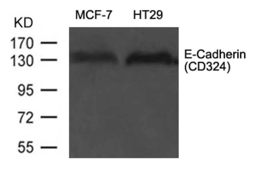 Western blot - E-Cadherin (CD324) Antibody from Signalway Antibody (21473) - Antibodies.com
