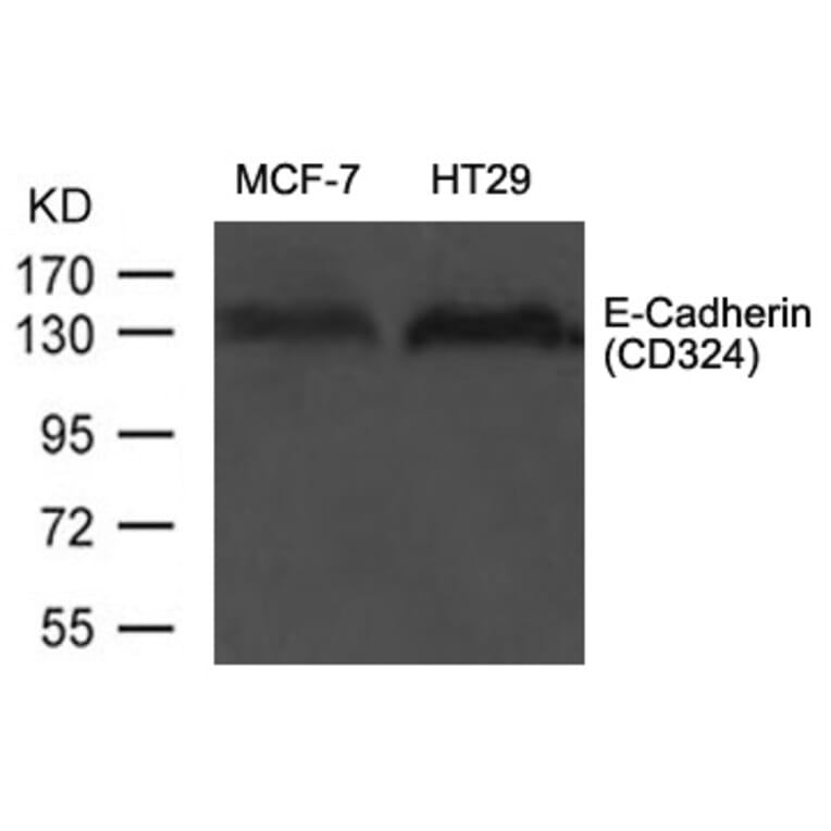 Western blot - E-Cadherin (CD324) Antibody from Signalway Antibody (21473) - Antibodies.com