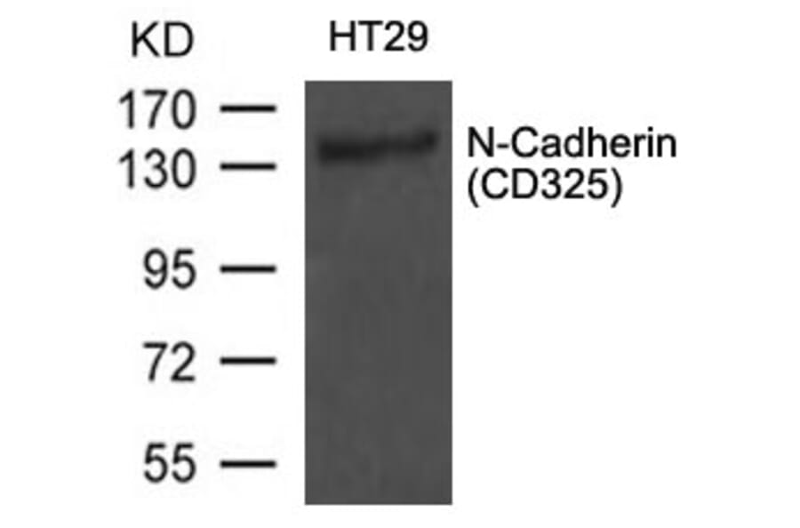 Western blot - N-Cadherin (CD325) Antibody from Signalway Antibody (21474) - Antibodies.com