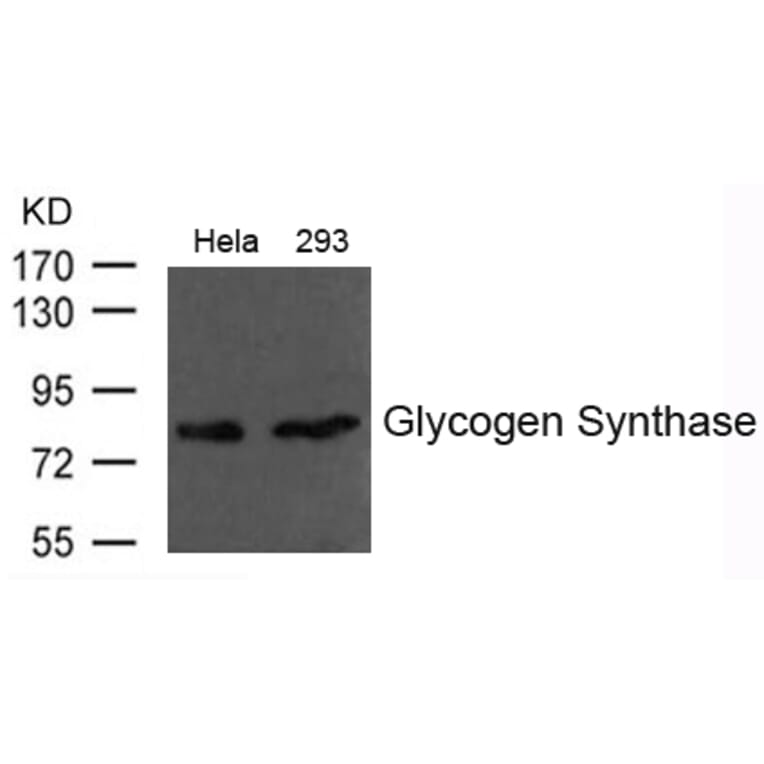 Western blot - Glycogen Synthase Antibody from Signalway Antibody (21613) - Antibodies.com