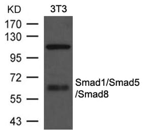 Western blot - Smad1/Smad5/Smad8 Antibody from Signalway Antibody (21684) - Antibodies.com