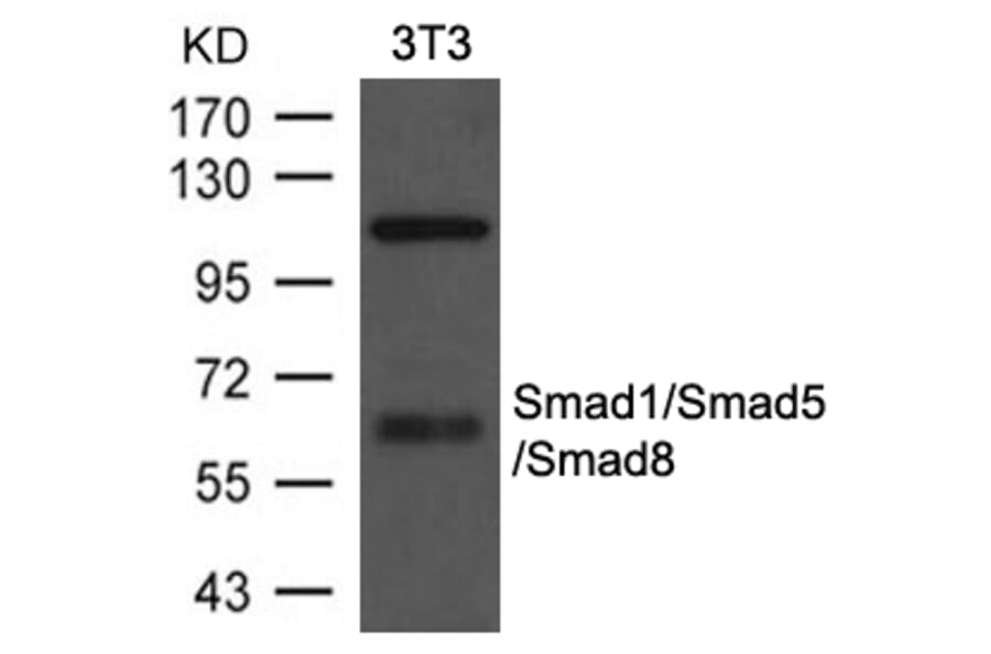 Western blot - Smad1/Smad5/Smad8 Antibody from Signalway Antibody (21684) - Antibodies.com