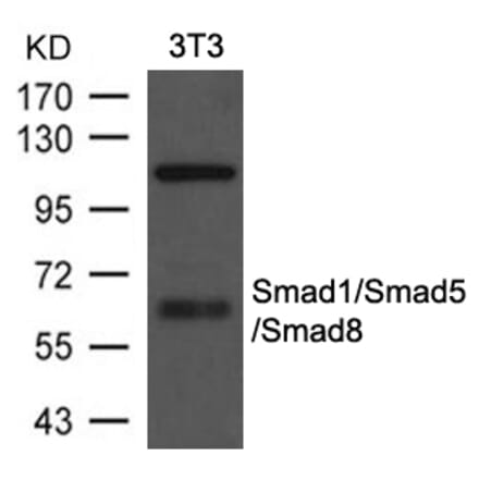 Western blot - Smad1/Smad5/Smad8 Antibody from Signalway Antibody (21684) - Antibodies.com