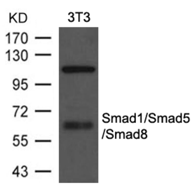 Western blot - Smad1/Smad5/Smad8 Antibody from Signalway Antibody (21684) - Antibodies.com