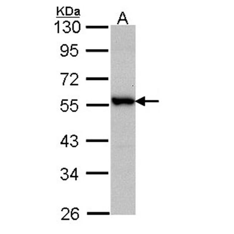 Docking protein 3 antibody from Signalway Antibody (22731) - Antibodies.com