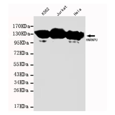 HNRNPU Monoclonal Antibody from Signalway Antibody (27076) - Antibodies.com