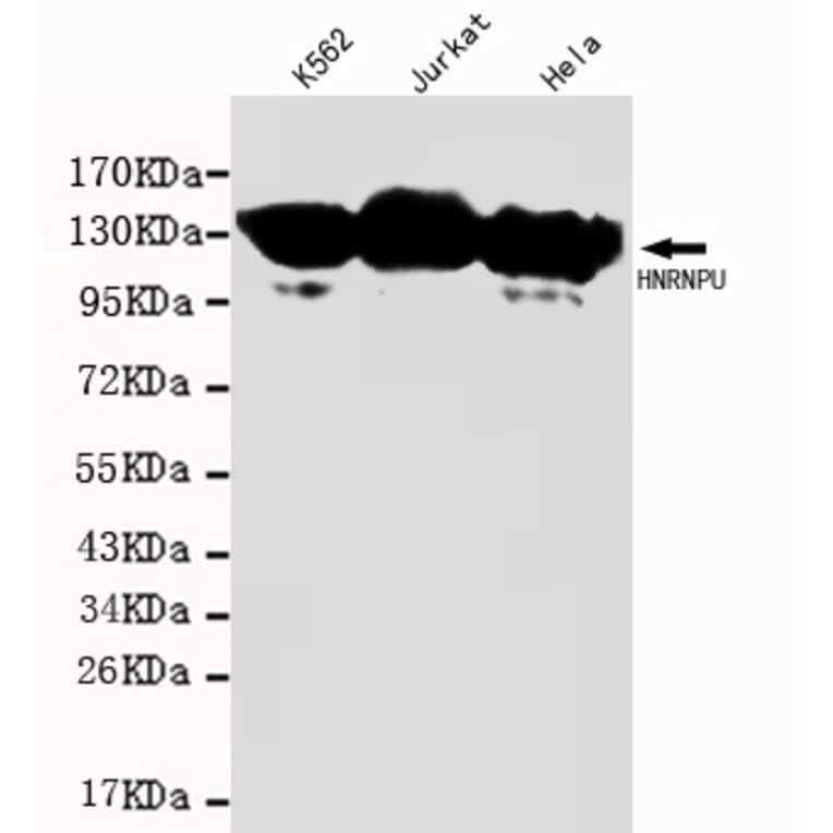 HNRNPU Monoclonal Antibody from Signalway Antibody (27076) - Antibodies.com