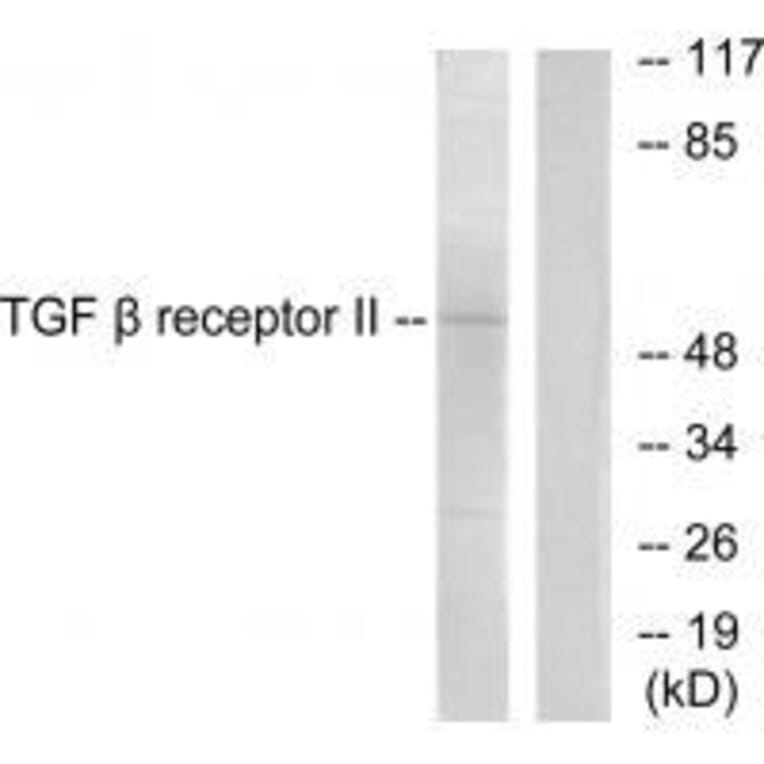 Western blot - TGF β Receptor II Antibody from Signalway Antibody (33496) - Antibodies.com