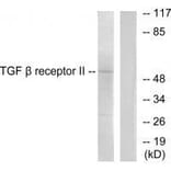 Western blot - TGF β Receptor II Antibody from Signalway Antibody (33496) - Antibodies.com
