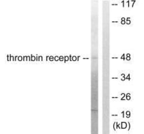 Western blot - Thrombin Receptor Antibody from Signalway Antibody (33500) - Antibodies.com