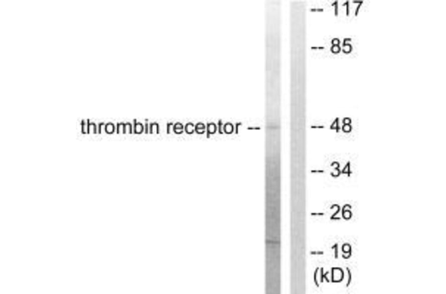 Western blot - Thrombin Receptor Antibody from Signalway Antibody (33500) - Antibodies.com