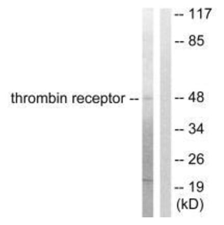 Western blot - Thrombin Receptor Antibody from Signalway Antibody (33500) - Antibodies.com