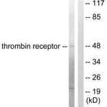 Western blot - Thrombin Receptor Antibody from Signalway Antibody (33500) - Antibodies.com