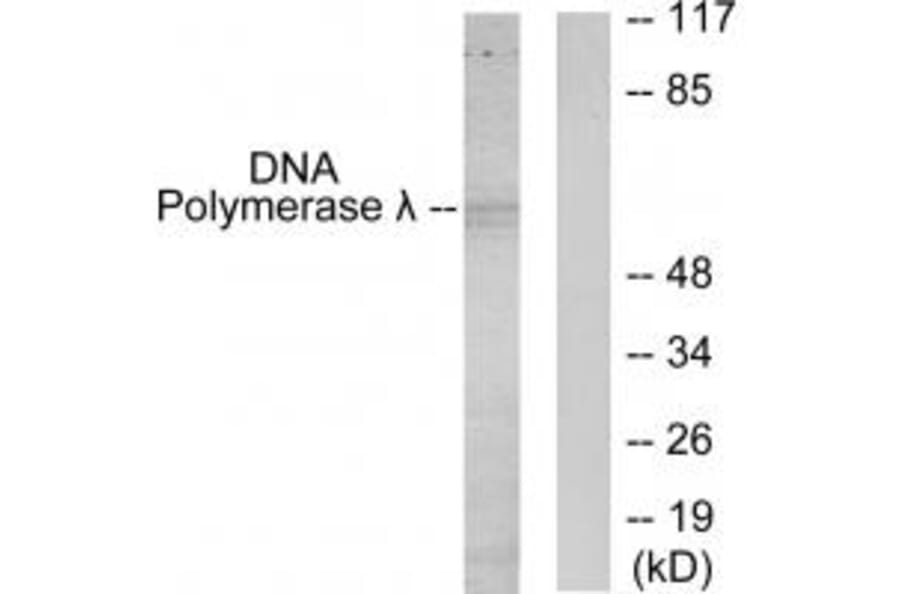 Western blot - DNA Polymerase λ Antibody from Signalway Antibody (34098) - Antibodies.com