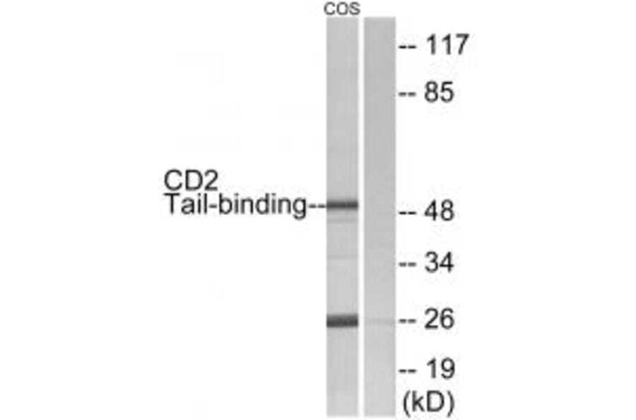 Western blot - CD2 Tail-binding Antibody from Signalway Antibody (34187) - Antibodies.com