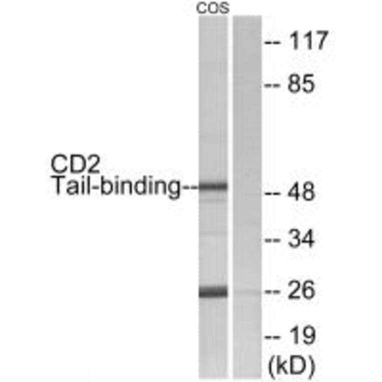 Western blot - CD2 Tail-binding Antibody from Signalway Antibody (34187) - Antibodies.com
