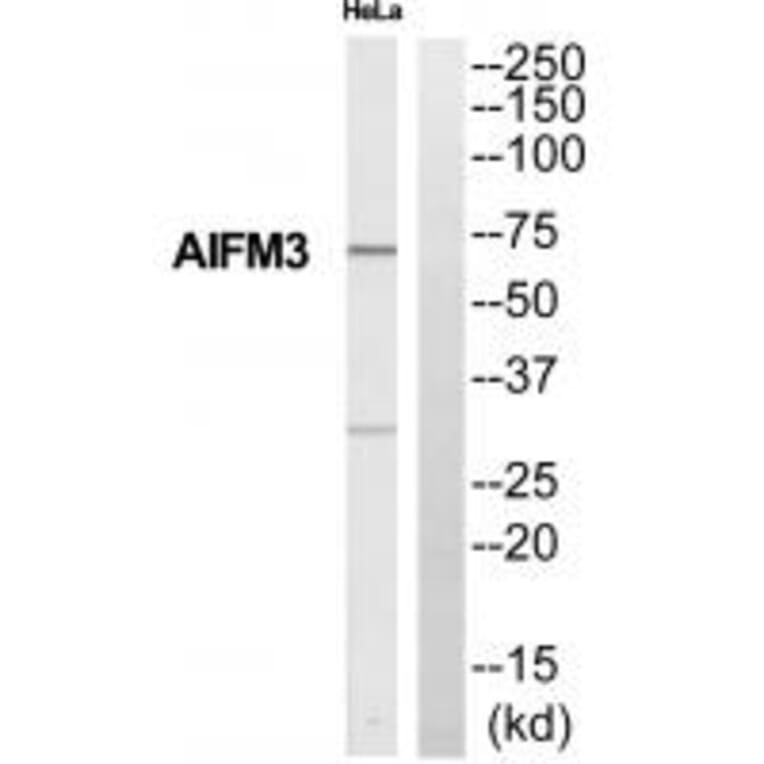 Western blot - Collagen XI alpha Antibody from Signalway Antibody (34211) - Antibodies.com