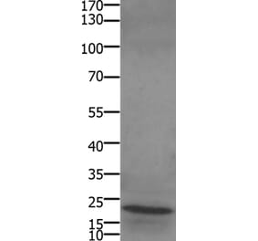 STMN2/STMN3/STMN4 Antibody from Signalway Antibody (36947) - Antibodies.com