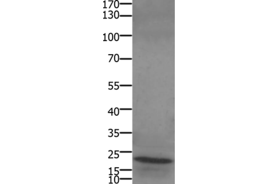 STMN2/STMN3/STMN4 Antibody from Signalway Antibody (36947) - Antibodies.com