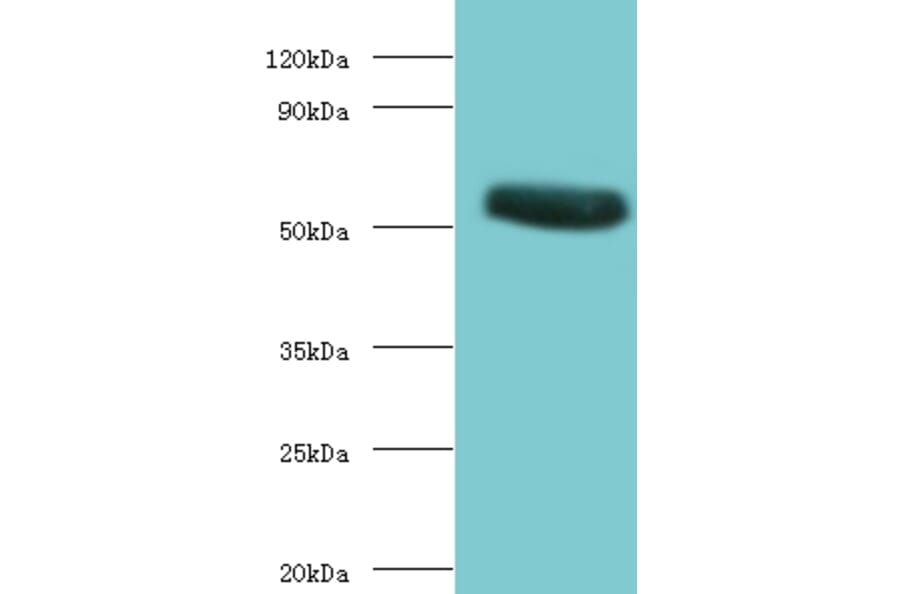 CHRNA1 Polyclonal Antibody from Signalway Antibody (42124) - Antibodies.com