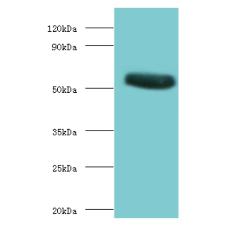 CHRNA1 Polyclonal Antibody from Signalway Antibody (42124) - Antibodies.com