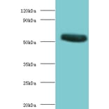 CHRNA1 Polyclonal Antibody from Signalway Antibody (42124) - Antibodies.com