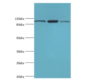EFTUD2 Polyclonal Antibody from Signalway Antibody (42648) - Antibodies.com