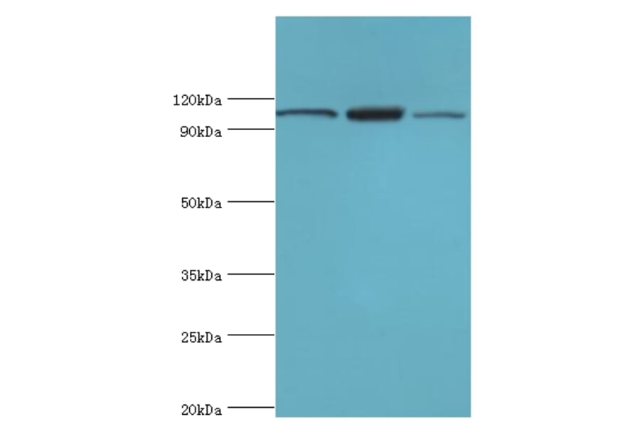 EFTUD2 Polyclonal Antibody from Signalway Antibody (42648) - Antibodies.com