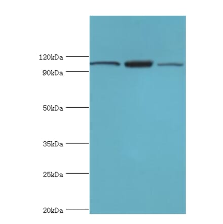 EFTUD2 Polyclonal Antibody from Signalway Antibody (42648) - Antibodies.com