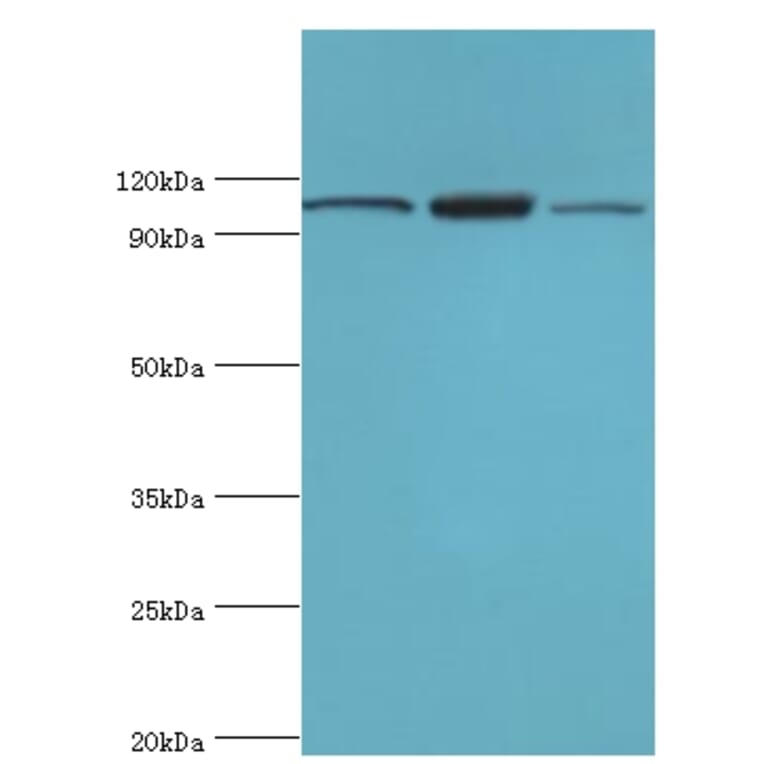 EFTUD2 Polyclonal Antibody from Signalway Antibody (42648) - Antibodies.com