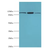 EFTUD2 Polyclonal Antibody from Signalway Antibody (42648) - Antibodies.com