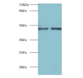 Eukaryotic initiation factor 4A-II Polyclonal Antibody from Signalway Antibody (42091) - Antibodies.com
