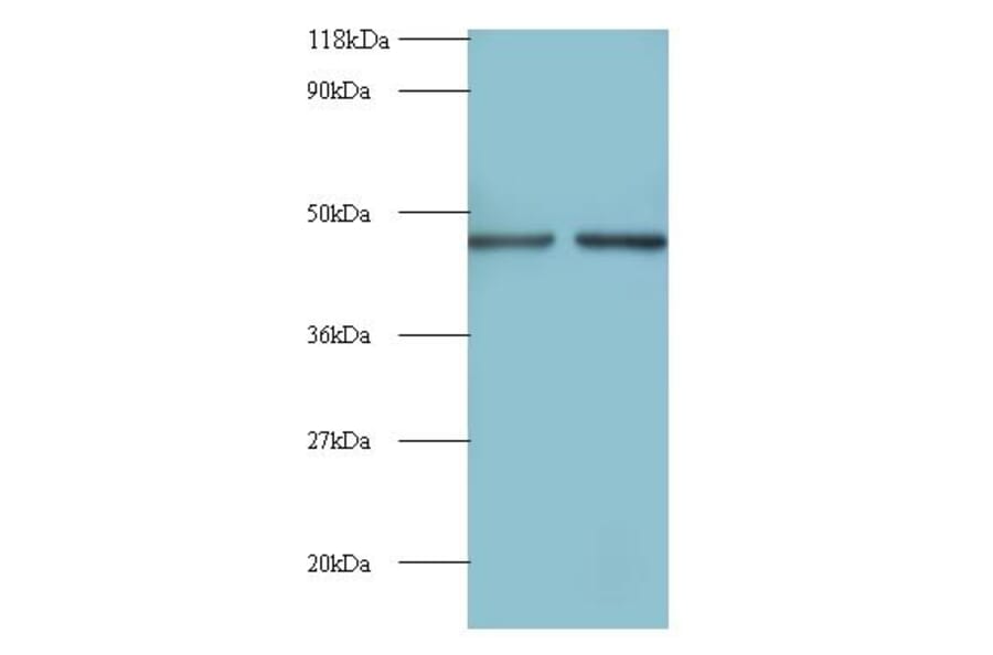 Eukaryotic initiation factor 4A-II Polyclonal Antibody from Signalway Antibody (42091) - Antibodies.com