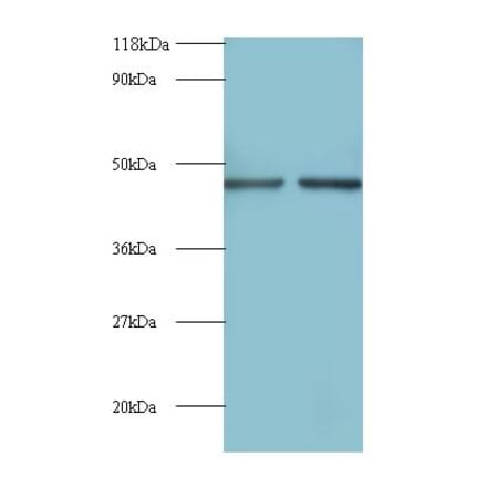 Eukaryotic initiation factor 4A-II Polyclonal Antibody from Signalway Antibody (42091) - Antibodies.com