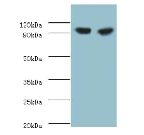 Glycogen phosphorylase, liver form Polyclonal Antibody from Signalway Antibody (42301) - Antibodies.com