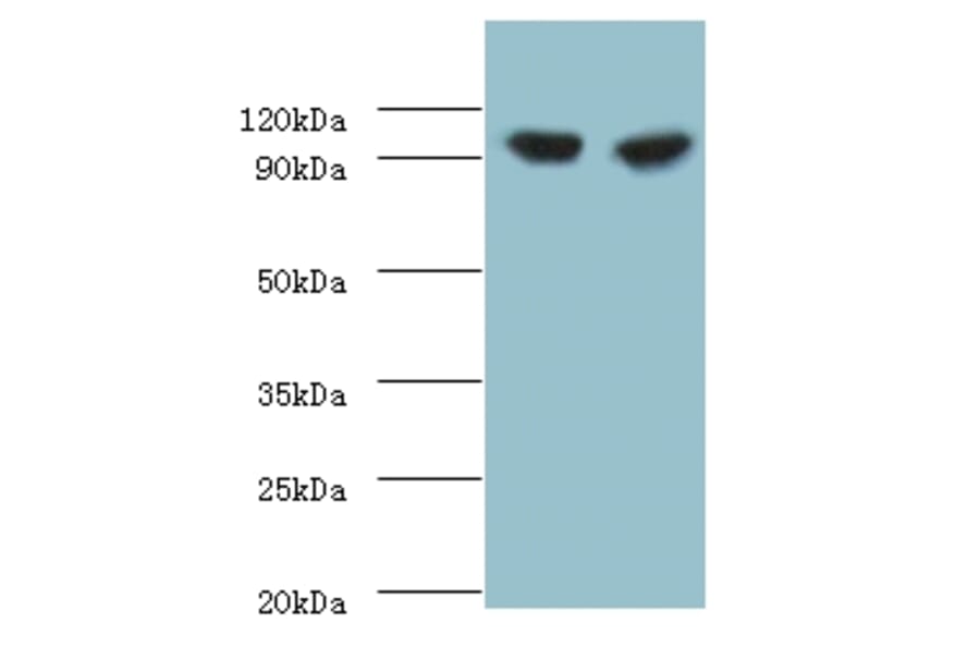 Glycogen phosphorylase, liver form Polyclonal Antibody from Signalway Antibody (42301) - Antibodies.com