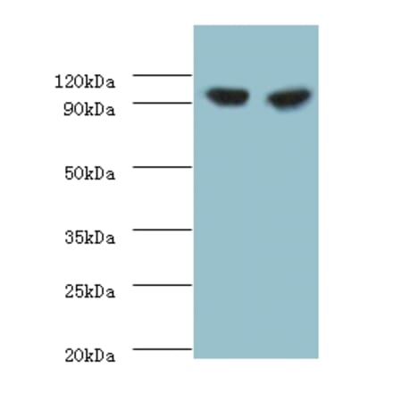 Glycogen phosphorylase, liver form Polyclonal Antibody from Signalway Antibody (42301) - Antibodies.com