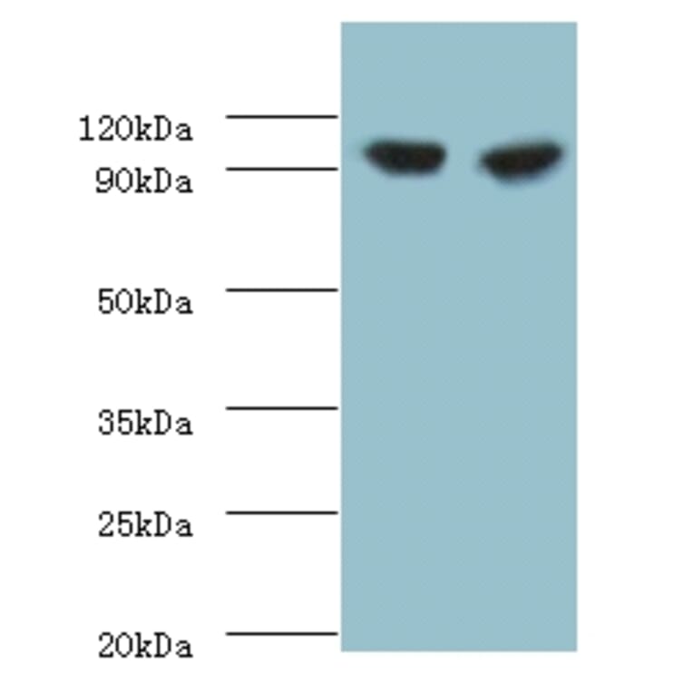Glycogen phosphorylase, liver form Polyclonal Antibody from Signalway Antibody (42301) - Antibodies.com