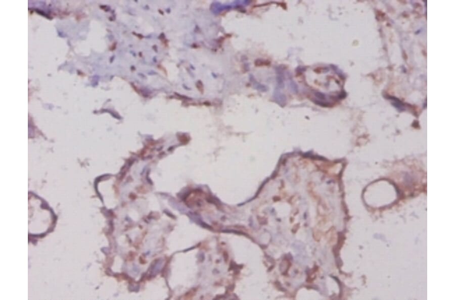 Immunohistochemistry - Glycogen phosphorylase, liver form Polyclonal Antibody from Signalway Antibody (42301)