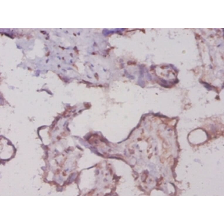 Immunohistochemistry - Glycogen phosphorylase, liver form Polyclonal Antibody from Signalway Antibody (42301)