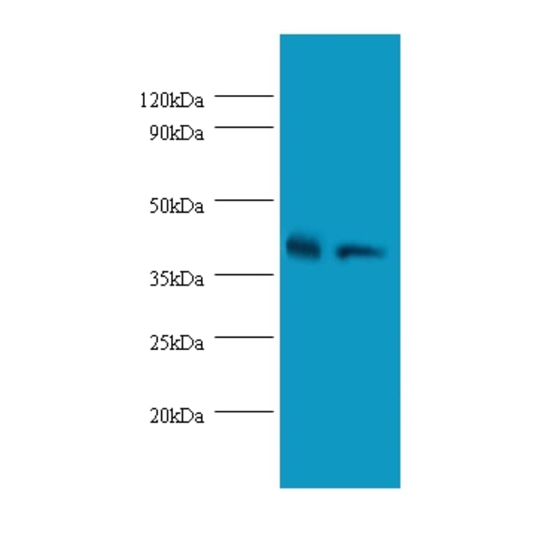Glutaminyl-peptide cyclotransferasePolyclonal Antibody from Signalway Antibody (42302) - Antibodies.com