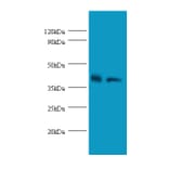 Glutaminyl-peptide cyclotransferasePolyclonal Antibody from Signalway Antibody (42302) - Antibodies.com