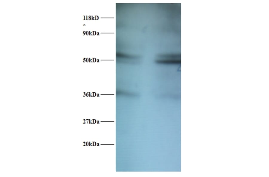 Seryl-tRNA synthetase, cytoplasmic Polyclonal Antibody from Signalway Antibody (42409) - Antibodies.com