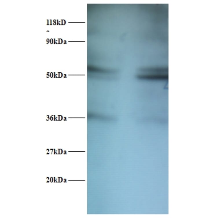 Seryl-tRNA synthetase, cytoplasmic Polyclonal Antibody from Signalway Antibody (42409) - Antibodies.com