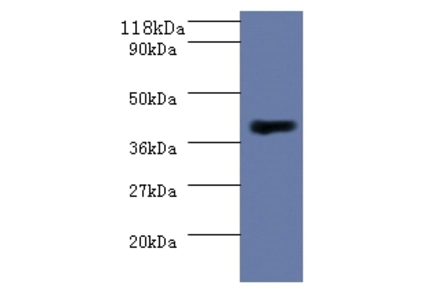 Homocysteine S-methyltransferase 1 Polyclonal Antibody from Signalway Antibody (42578) - Antibodies.com