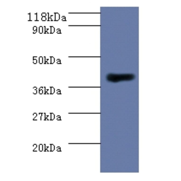 Homocysteine S-methyltransferase 1 Polyclonal Antibody from Signalway Antibody (42578) - Antibodies.com