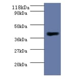 Homocysteine S-methyltransferase 1 Polyclonal Antibody from Signalway Antibody (42578) - Antibodies.com