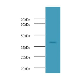 Ubiquitin-conjugating enzyme E2 Q2 Polyclonal Antibody from Signalway Antibody (42667) - Antibodies.com