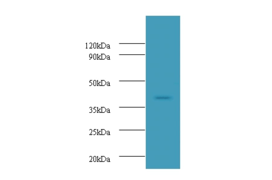 Ubiquitin-conjugating enzyme E2 Q2 Polyclonal Antibody from Signalway Antibody (42667) - Antibodies.com